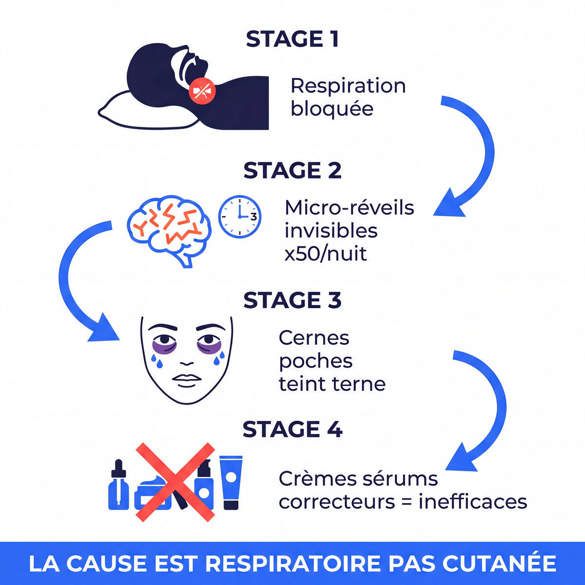Gouttières Somnicare